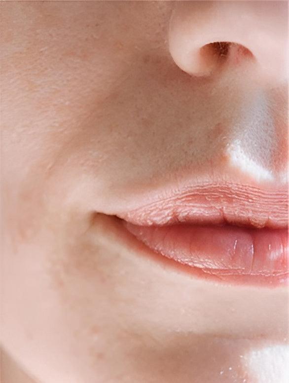 Close-up of lips showcasing the Eclat Soin Sensitive Skin Moisturiser for hydration and softness